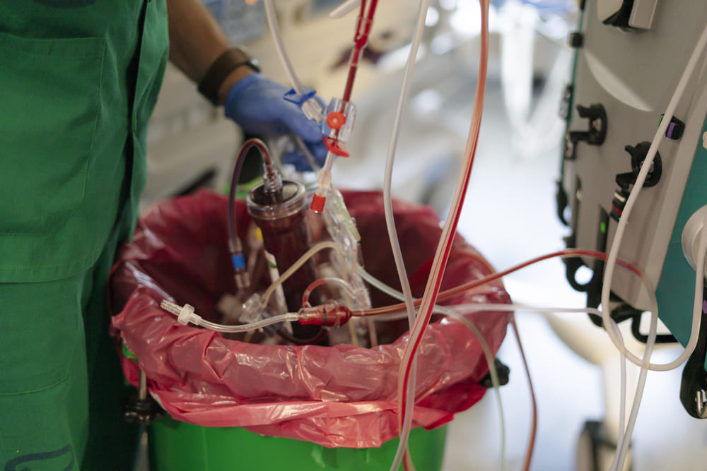 Diálisis en Guatemala