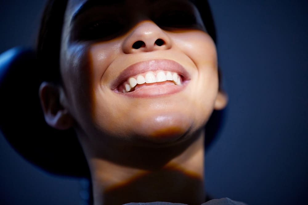 carillas dentales