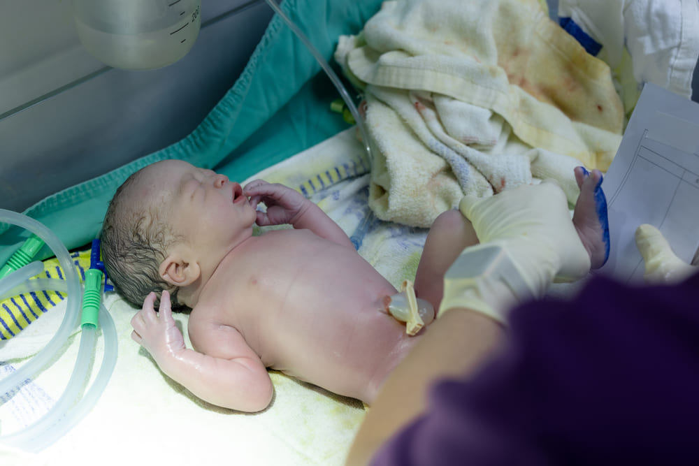 Tamizaje neonatal en Ciudad de Guatemala