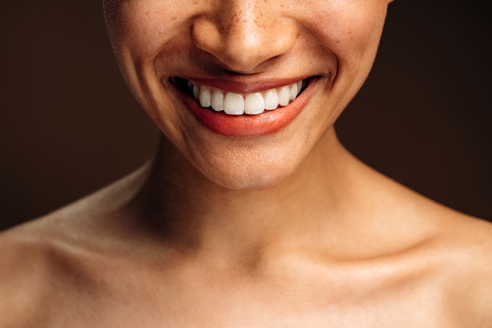 diseño de sonrisa en Panamá