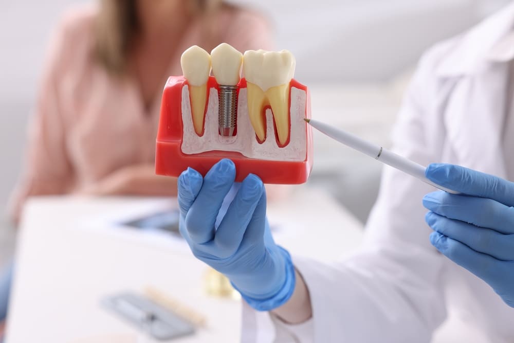 Endodoncia: la mejor solución en Panamá