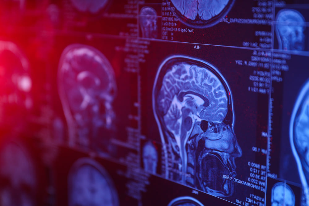 Hospital El Pilar organiza encuentro para analizar nuevos retos en neurocirugía de alta complejidad en Guatemala