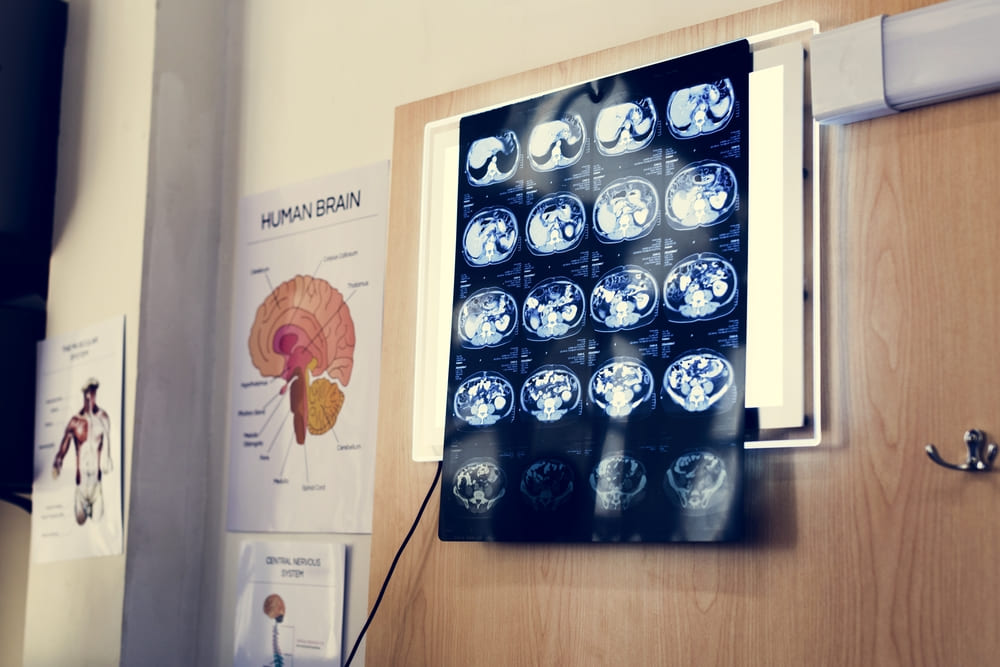Neuro Leaders Forum en Guatemala: un espacio para compartir conocimientos especializados