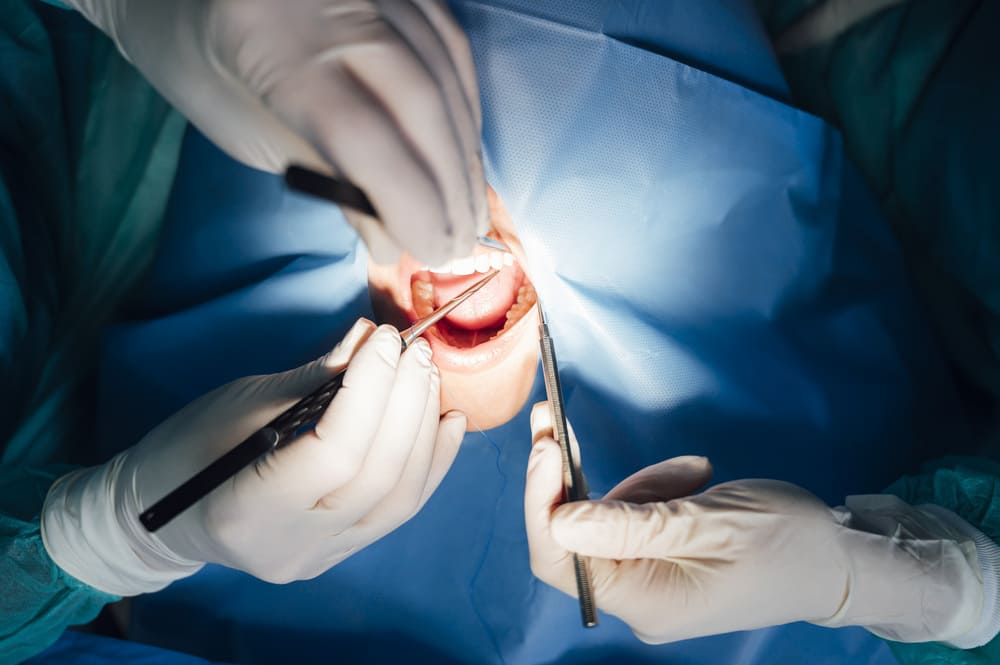 Rehabilitación oral completa en Panamá: evaluación integral de dientes, encías y huesos