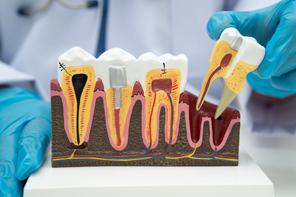 Evaluación periodontal en Panamá para mantener encías sanas y fuertes