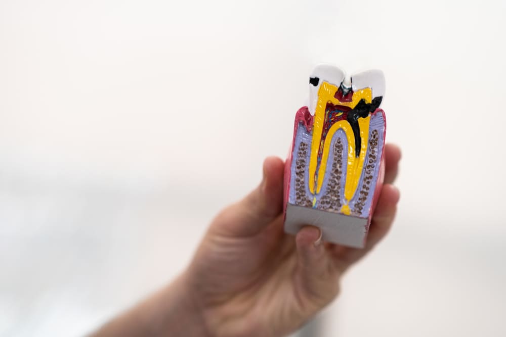 Evaluación periodontal integral en Panamá para encías sanas