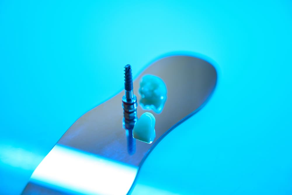 Rehabilitación oral completa para restaurar dientes y mordida dañada en Panamá