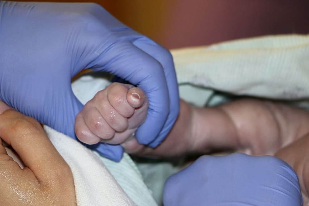 Hospital El Pilar promueve el tamizaje neonatal en Ciudad de Guatemala